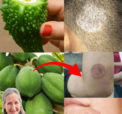 9 Ultimate Home Remedies to Eradicate Fungal Infections Fast and Naturally – dogpjs.com 9 Ultimate Home Remedies to Eradicate Fungal Infections Fast and Naturally – dogpjs.com
