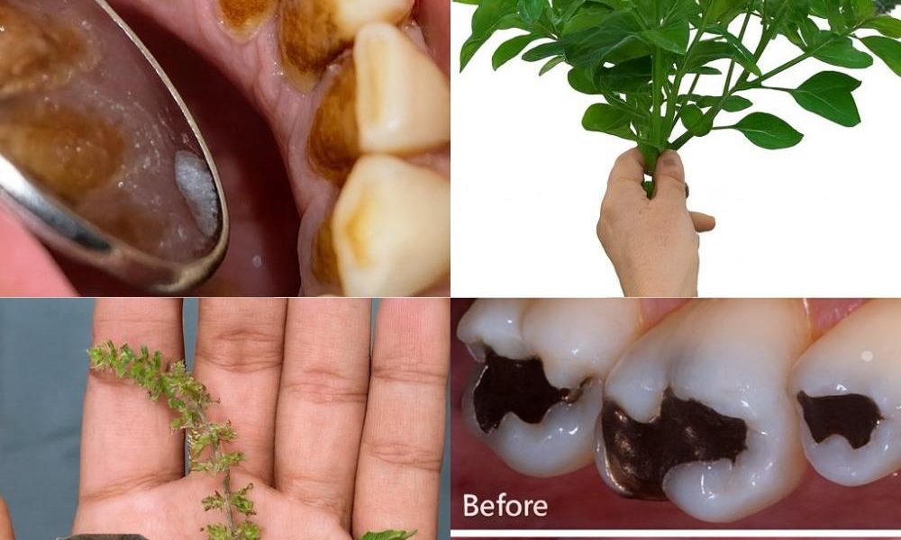 Nature’s Secret for Perfect Oral Health 🌿 Nature’s Secret for Perfect Oral Health 🌿