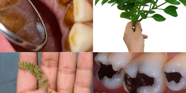 Nature’s Secret for Perfect Oral Health 🌿 Nature’s Secret for Perfect Oral Health 🌿