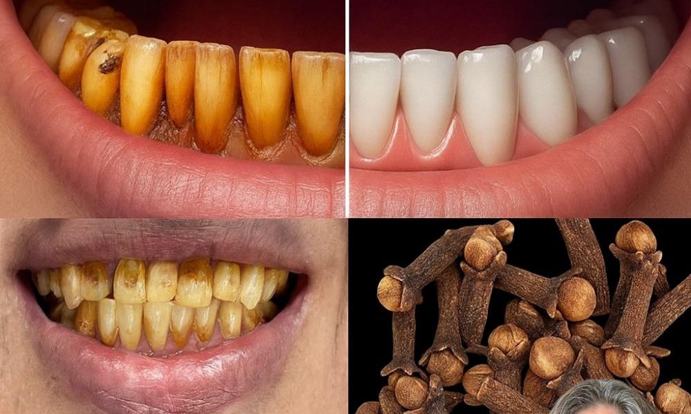 The Hidden Power of Cloves for Vibrant Oral Health The Hidden Power of Cloves for Vibrant Oral Health
