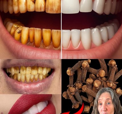 The Hidden Power of Cloves for Vibrant Oral Health The Hidden Power of Cloves for Vibrant Oral Health