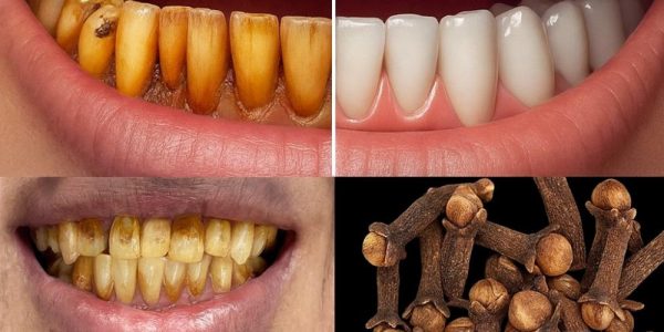The Hidden Power of Cloves for Vibrant Oral Health The Hidden Power of Cloves for Vibrant Oral Health