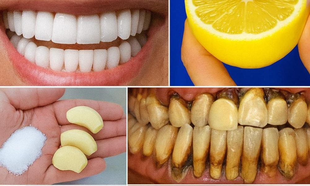 The Lemon and Baking Soda Secret to a Radiant Smile The Lemon and Baking Soda Secret to a Radiant Smile