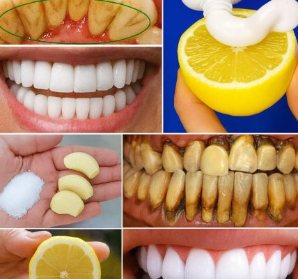 The Lemon and Baking Soda Secret to a Radiant Smile The Lemon and Baking Soda Secret to a Radiant Smile