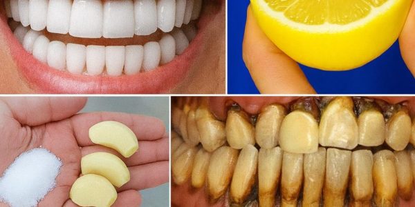 The Lemon and Baking Soda Secret to a Radiant Smile The Lemon and Baking Soda Secret to a Radiant Smile