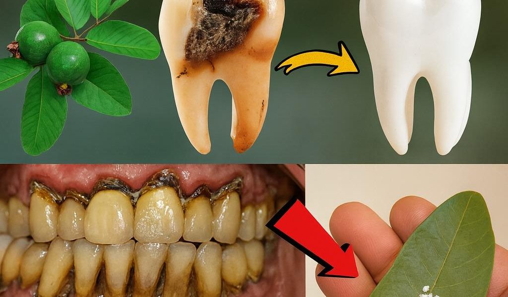 3 Ingenious Guava Leaf Remedies for Tooth Decay – dogpjs.com 3 Ingenious Guava Leaf Remedies for Tooth Decay – dogpjs.com