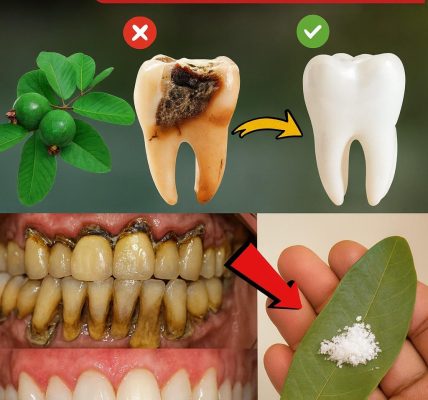 3 Ingenious Guava Leaf Remedies for Tooth Decay – dogpjs.com 3 Ingenious Guava Leaf Remedies for Tooth Decay – dogpjs.com