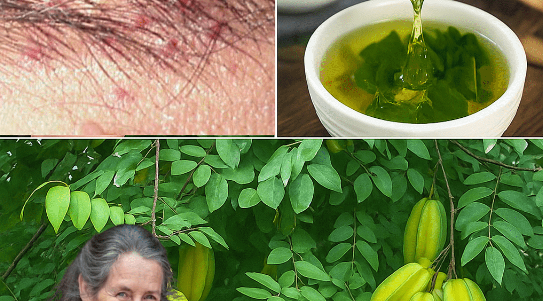 đ The Hidden Leaf That Banishes Hives and Revives Your Vitality Overnight â dogpjs.com đ The Hidden Leaf That Banishes Hives and Revives Your Vitality Overnight â dogpjs.com