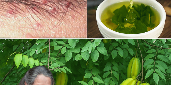 🌟 The Hidden Leaf That Banishes Hives and Revives Your Vitality Overnight – dogpjs.com