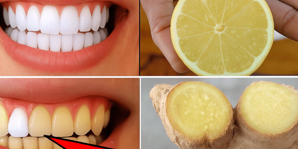 The Secret to a Whiter, Fresher You – dogpjs.com The Secret to a Whiter, Fresher You – dogpjs.com