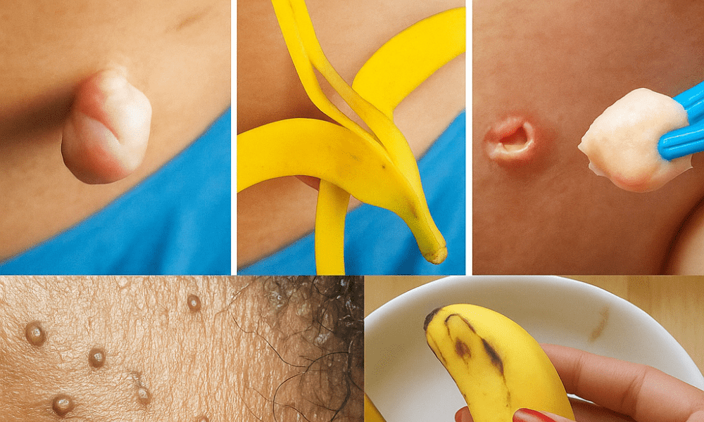 Unlock Radiant, Youthful Skin with Banana Peels in Just Days Unlock Radiant, Youthful Skin with Banana Peels in Just Days
