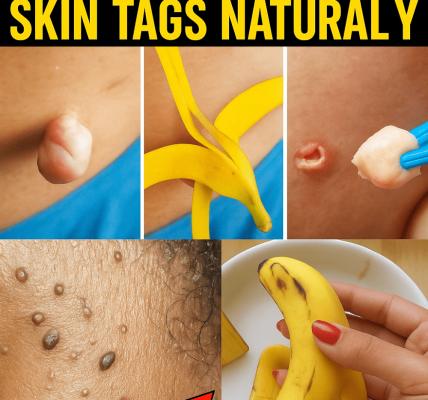 Unlock Radiant, Youthful Skin with Banana Peels in Just Days Unlock Radiant, Youthful Skin with Banana Peels in Just Days