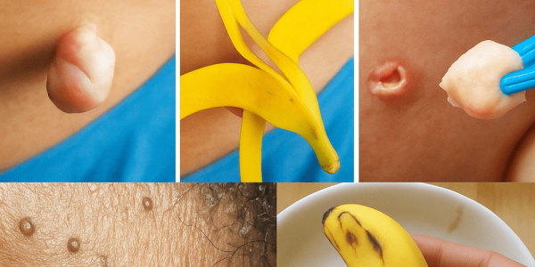 Unlock Radiant, Youthful Skin with Banana Peels in Just Days Unlock Radiant, Youthful Skin with Banana Peels in Just Days
