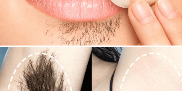 The Ultimate Guide to Natural Hair Removal The Ultimate Guide to Natural Hair Removal