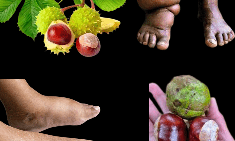 Horse Chestnut’s Natural Power for Swelling and Beyond Horse Chestnut’s Natural Power for Swelling and Beyond