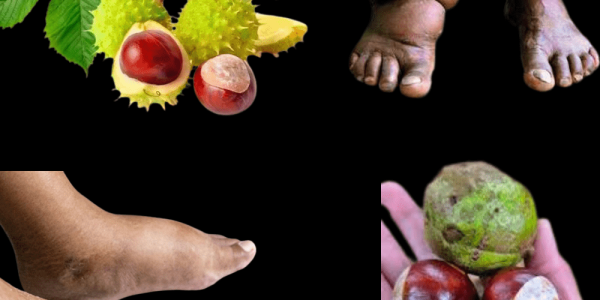 Horse Chestnut’s Natural Power for Swelling and Beyond Horse Chestnut’s Natural Power for Swelling and Beyond