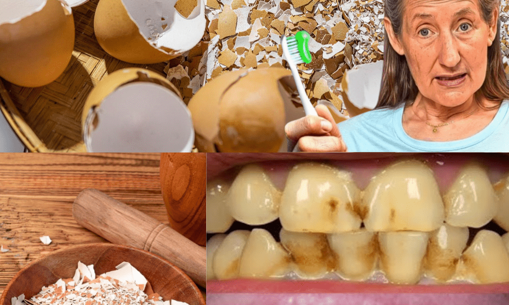 The Kitchen Secret to Whiter Teeth Revealed The Kitchen Secret to Whiter Teeth Revealed