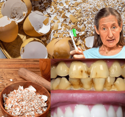 The Kitchen Secret to Whiter Teeth Revealed The Kitchen Secret to Whiter Teeth Revealed