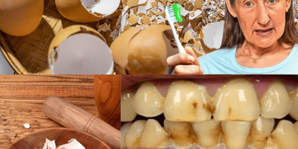 The Kitchen Secret to Whiter Teeth Revealed