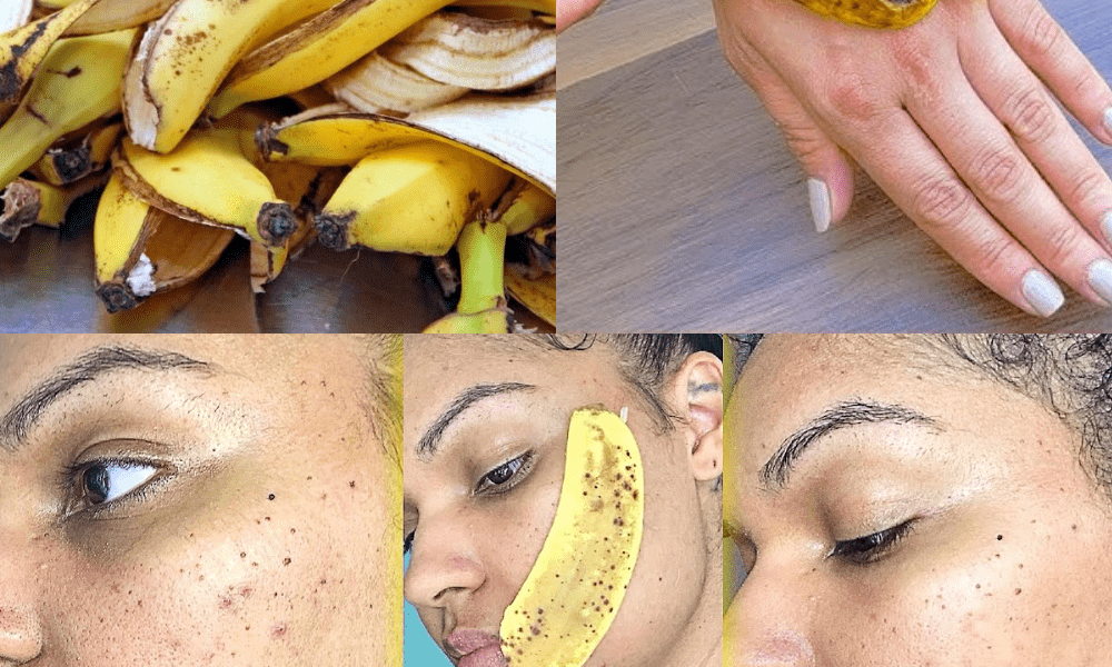The Surprising Power of Banana Peels for Natural Skin Care The Surprising Power of Banana Peels for Natural Skin Care