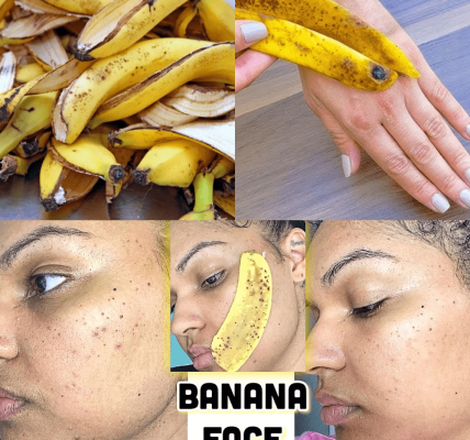 The Surprising Power of Banana Peels for Natural Skin Care The Surprising Power of Banana Peels for Natural Skin Care