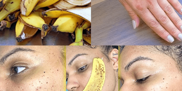 The Surprising Power of Banana Peels for Natural Skin Care The Surprising Power of Banana Peels for Natural Skin Care