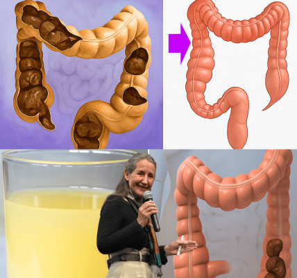 Flush 13kg of Toxic Colon Waste Overnight with This Secret Remedy – dogpjs.com Flush 13kg of Toxic Colon Waste Overnight with This Secret Remedy – dogpjs.com