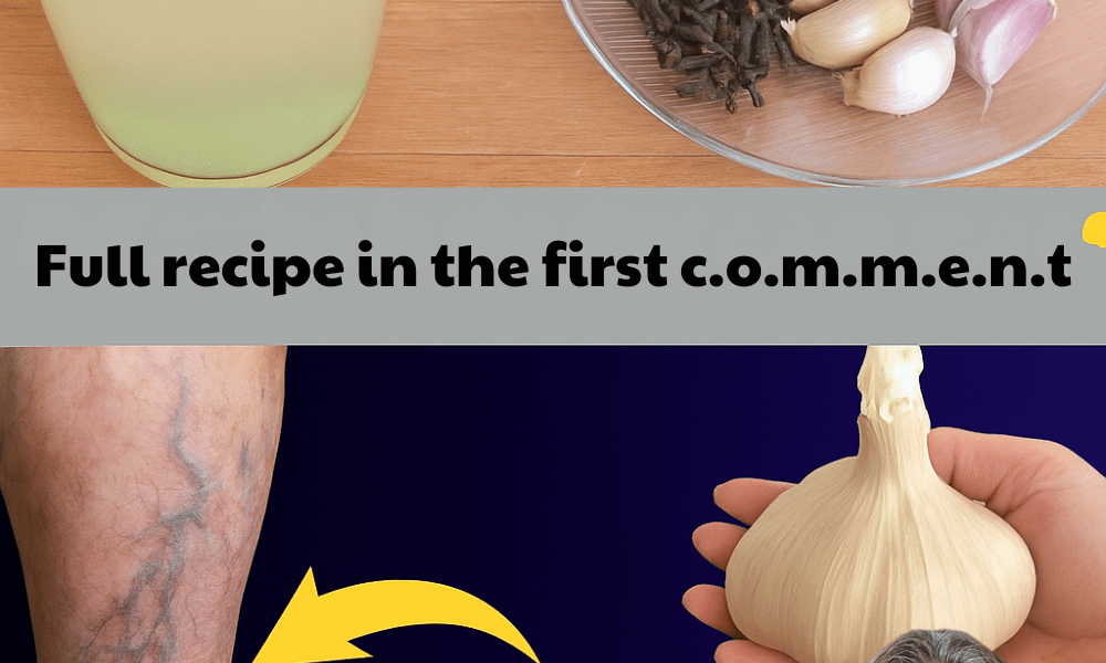 Could Garlic and Clove Oil Secretly Banish Your Varicose Veins Forever? – dogpjs.com