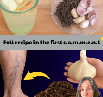 Could Garlic and Clove Oil Secretly Banish Your Varicose Veins Forever? – dogpjs.com Could Garlic and Clove Oil Secretly Banish Your Varicose Veins Forever? – dogpjs.com