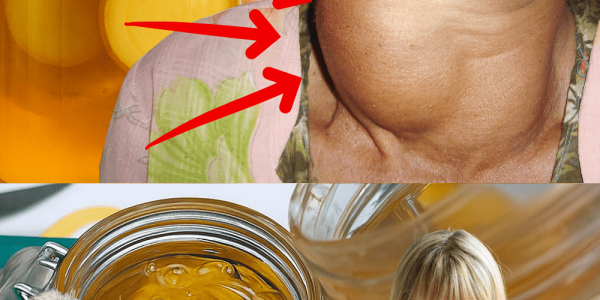 Natural Turmeric & Honey Formula to Support Thyroid Health – Inspired by Barbara O’Neill – dogpjs.com