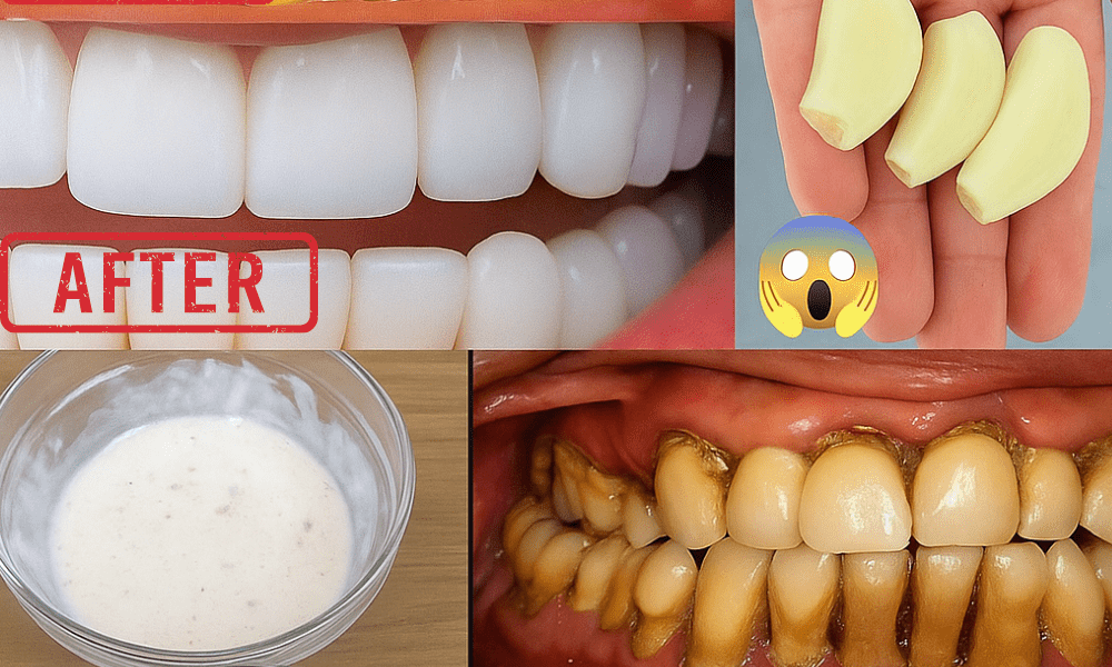 Discover the 2-Day Garlic-Salt Secret to Dazzling White Teeth Naturally! – dogpjs.com Discover the 2-Day Garlic-Salt Secret to Dazzling White Teeth Naturally! – dogpjs.com