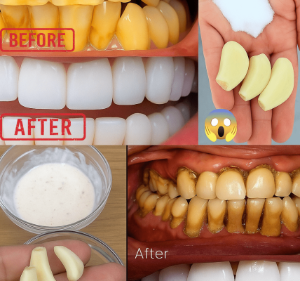 Discover the 2-Day Garlic-Salt Secret to Dazzling White Teeth Naturally! – dogpjs.com Discover the 2-Day Garlic-Salt Secret to Dazzling White Teeth Naturally! – dogpjs.com