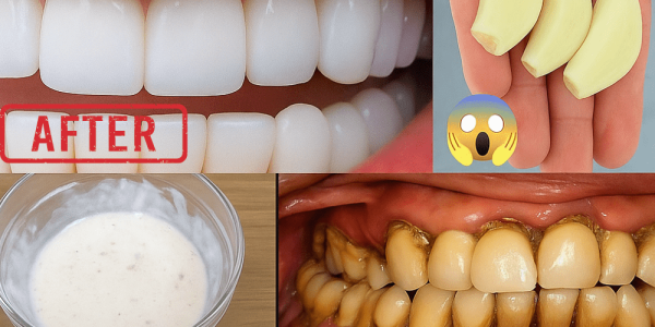 Discover the 2-Day Garlic-Salt Secret to Dazzling White Teeth Naturally! – dogpjs.com Discover the 2-Day Garlic-Salt Secret to Dazzling White Teeth Naturally! – dogpjs.com
