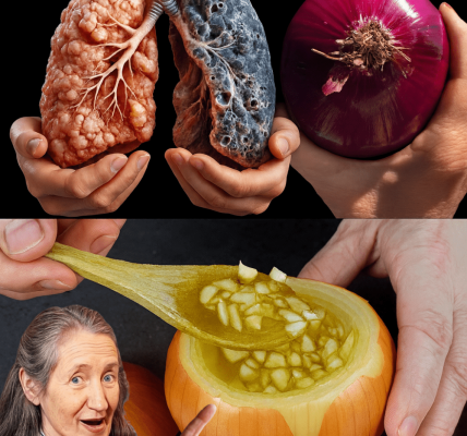 The Astonishing Antibiotic Power of Onions for Cough, Bronchitis, and Pneumonia The Astonishing Antibiotic Power of Onions for Cough, Bronchitis, and Pneumonia