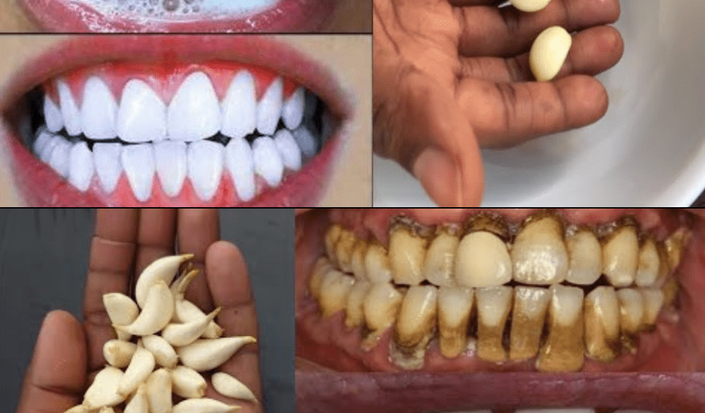 Transform Your Smile with Garlic Transform Your Smile with Garlic