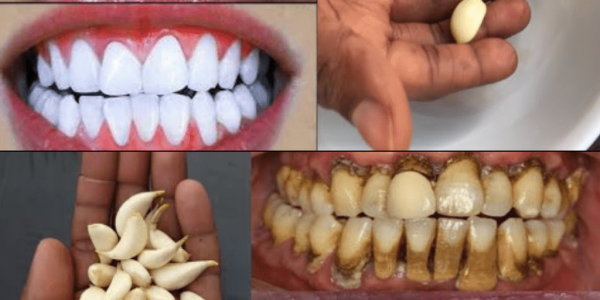 Transform Your Smile with Garlic Transform Your Smile with Garlic