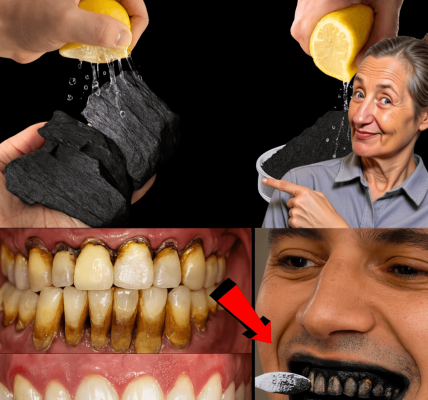 🌟 Unlock the Secret to a Radiant, Healthy Smile Naturally 🌟 Unlock the Secret to a Radiant, Healthy Smile Naturally