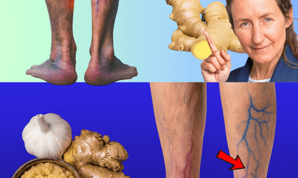 šæ Unlock the Secret to Lighter, Healthier Legs with Garlic and Ginger šæ Unlock the Secret to Lighter, Healthier Legs with Garlic and Ginger