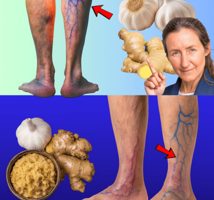 🌿 Unlock the Secret to Lighter, Healthier Legs with Garlic and Ginger 🌿 Unlock the Secret to Lighter, Healthier Legs with Garlic and Ginger