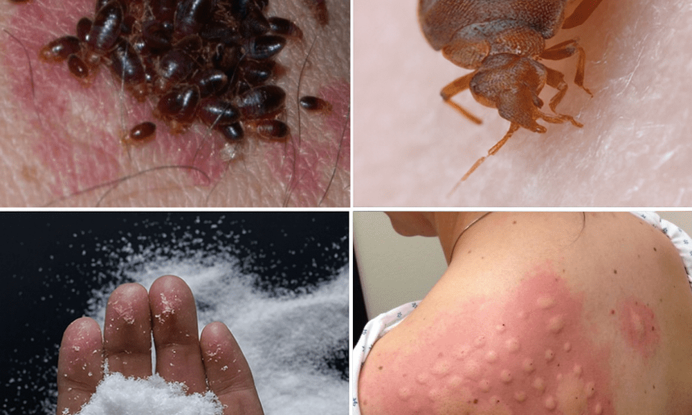 Proven Strategies to Banish These Sneaky Pests from Your Home Proven Strategies to Banish These Sneaky Pests from Your Home