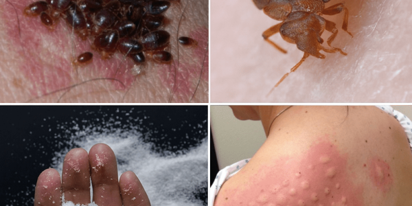 Proven Strategies to Banish These Sneaky Pests from Your Home Proven Strategies to Banish These Sneaky Pests from Your Home