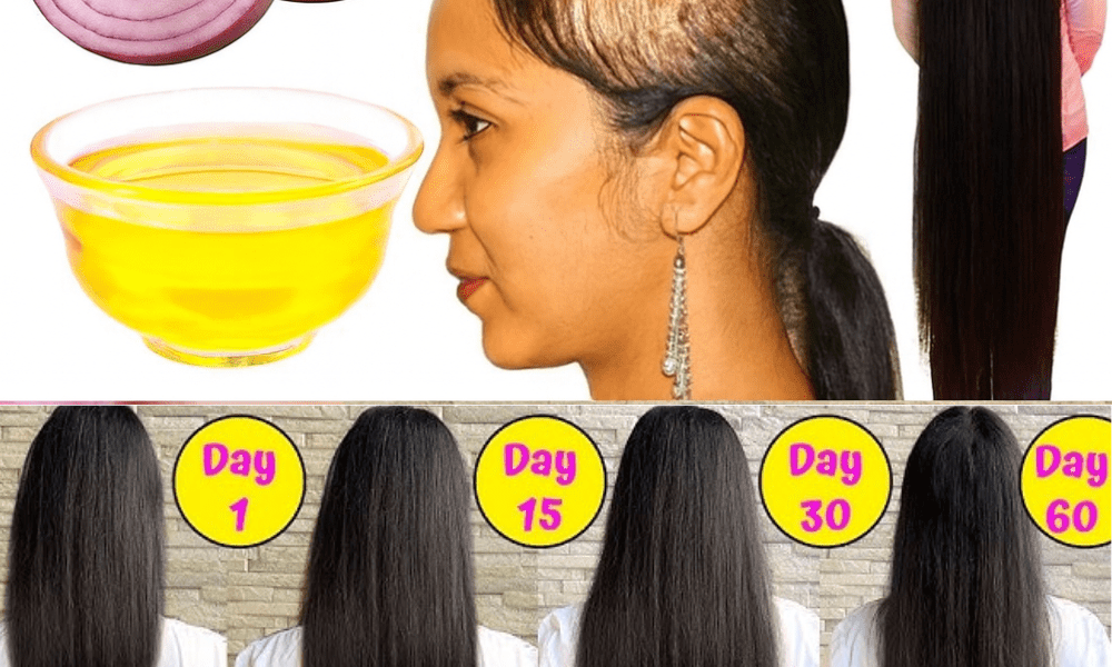 Transform Your Locks with Homemade Onion Oil Transform Your Locks with Homemade Onion Oil