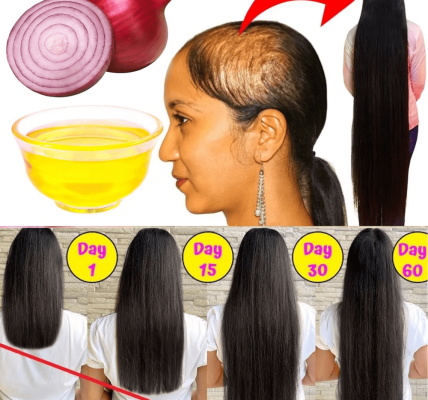 Transform Your Locks with Homemade Onion Oil Transform Your Locks with Homemade Onion Oil