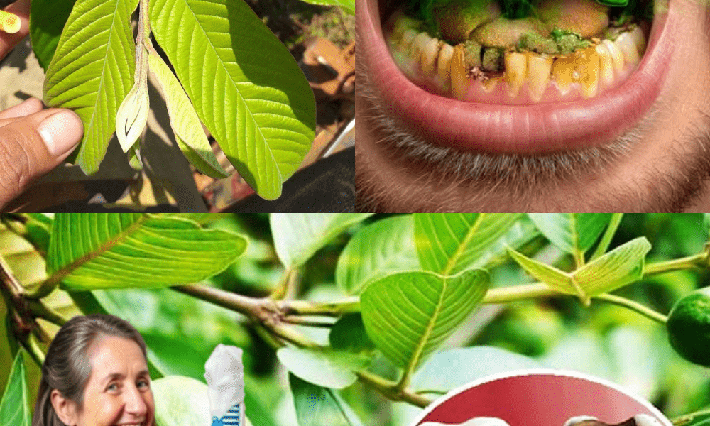 3 Genius Ways to Use Guava Leaves to Fight Tooth Decay 3 Genius Ways to Use Guava Leaves to Fight Tooth Decay