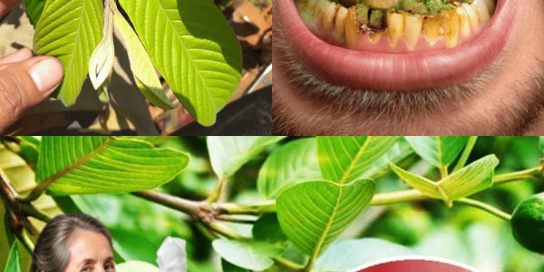 3 Genius Ways to Use Guava Leaves to Fight Tooth Decay 3 Genius Ways to Use Guava Leaves to Fight Tooth Decay