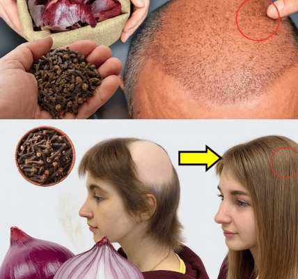 The Cloves and Onion Peel Miracle for Explosive Hair Growth The Cloves and Onion Peel Miracle for Explosive Hair Growth