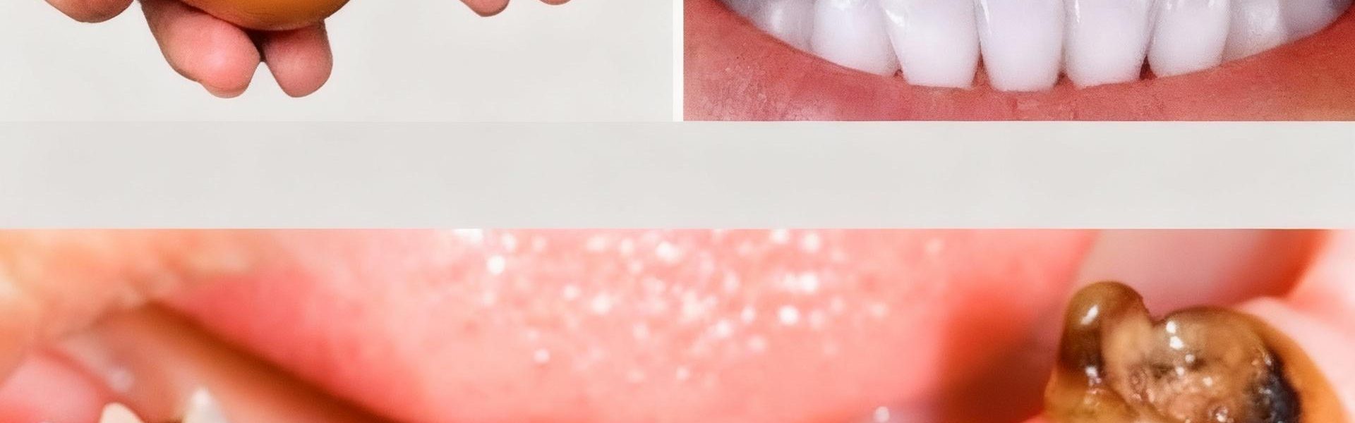 What If Your Trash Held the Secret to a Hollywood Smile? – dogpjs.com What If Your Trash Held the Secret to a Hollywood Smile? – dogpjs.com