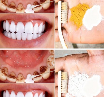 😁 Unlock a Dazzling Smile in Just 2 Minutes with This Kitchen Secret! 😁 Unlock a Dazzling Smile in Just 2 Minutes with This Kitchen Secret!