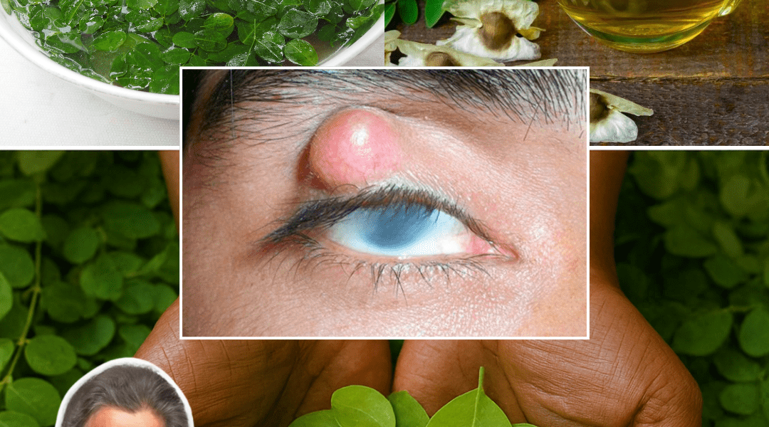 The Miracle Tree That Can Transform Your Health in 2025 – dogpjs.com