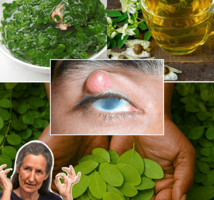 The Miracle Tree That Can Transform Your Health in 2025 – dogpjs.com The Miracle Tree That Can Transform Your Health in 2025 – dogpjs.com